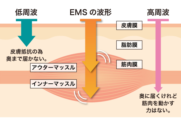 EMSの波形