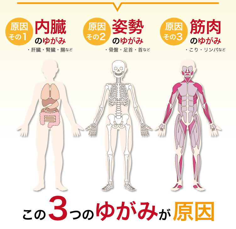 1.内臓2.姿勢3.筋肉この3つのゆがみが原因であると考えられます。